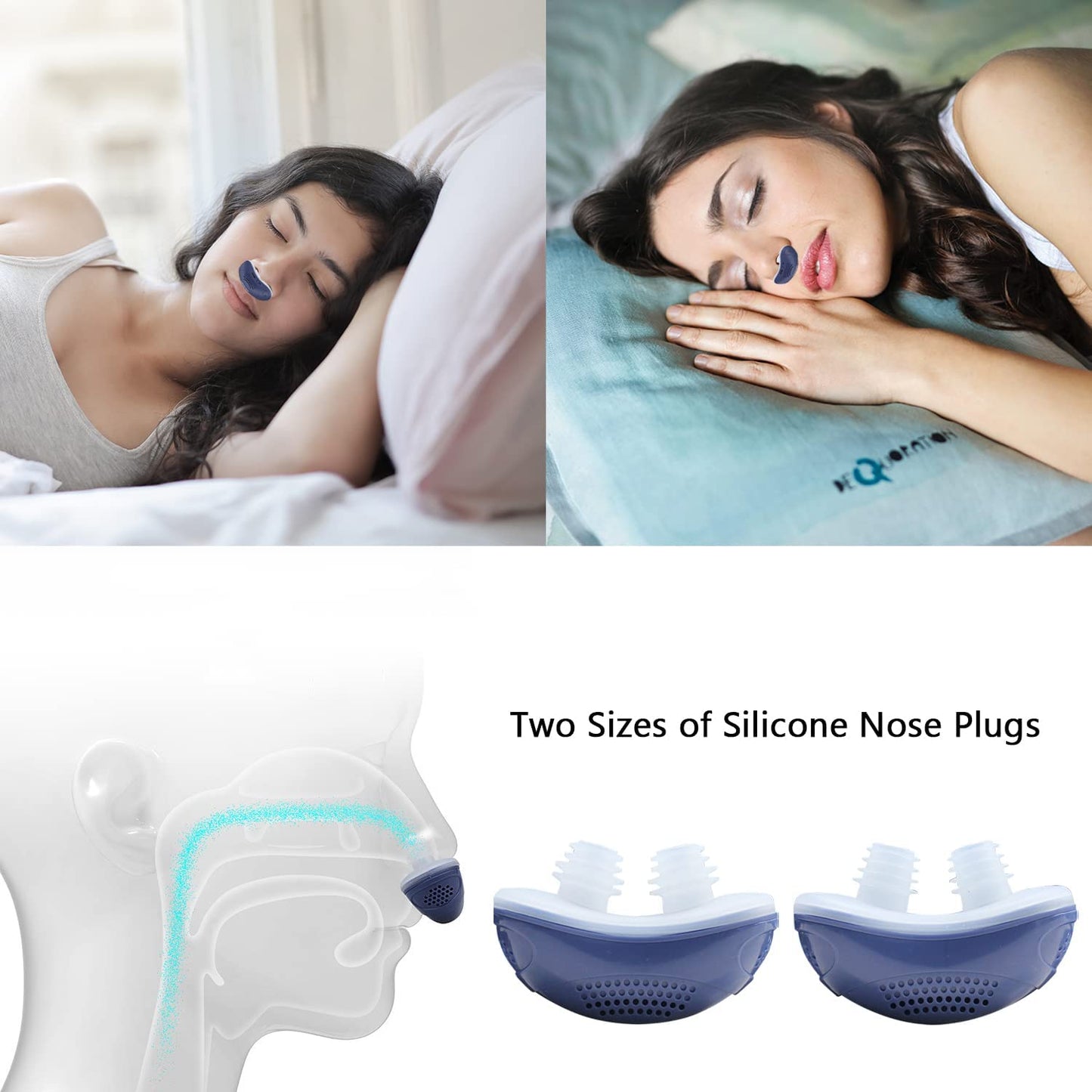 Anti-Snoring Device | Cordless, Maskless Micro-CPAP