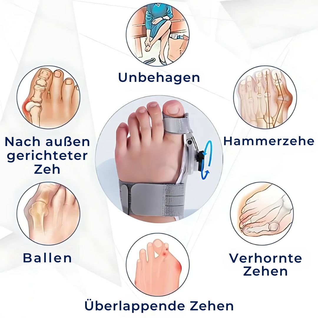 BunionEase Adjustable Relief Supports | Hallux Valgus Corrector