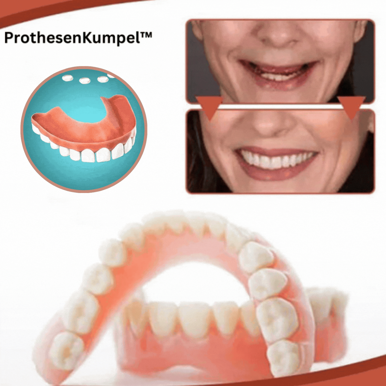 FleekFit | Biocompatible Silicone Prosthesis Set for Pain-Free Fit and Natural Smile