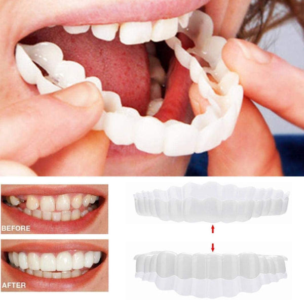 FleekFit | On Smile Veneers (Upper and Lower Jaw included)