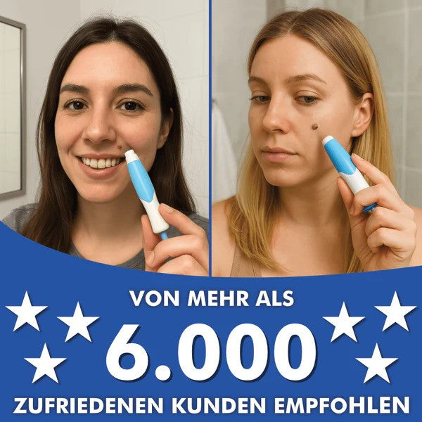 FleekFit Wart-Free PRO - The Professional Wart Remover