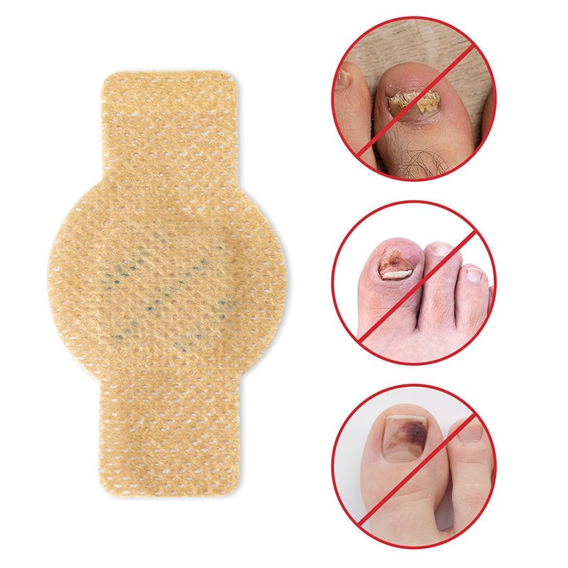 FungalPatch - Antibacterial Fungal Infection Patches and Nail Care Pack