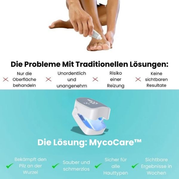 MycoCare™ - Laser Nail Fungus Treatment Device