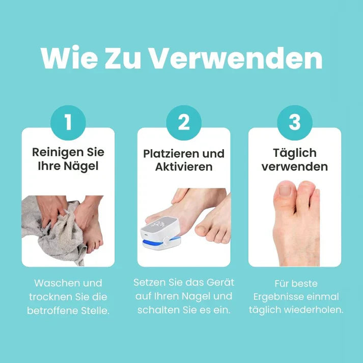 MycoCare™ - Laser Nail Fungus Treatment Device