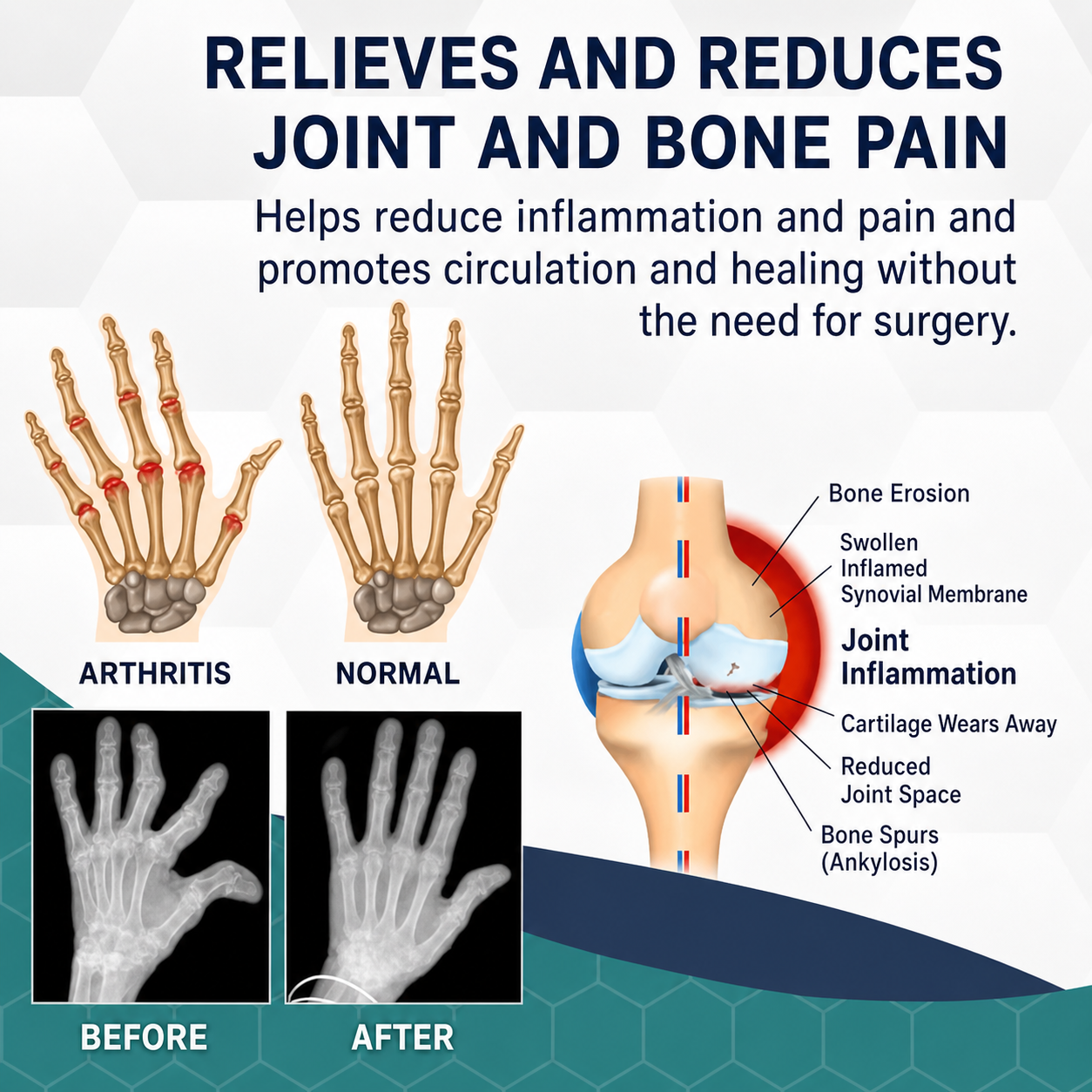 Pain Relief | Bee Venom Care for Joints | Warming Deep Action Massage | BeeRelief