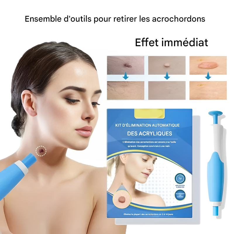 Wart Removal Kit - Simple Cryotherapy