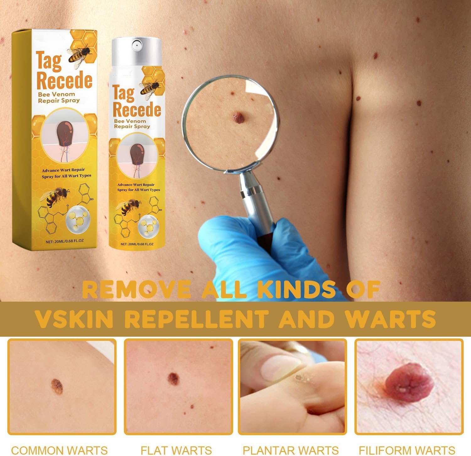 Wart Remover | Targeted Skin Spray | Bee Venom Care Formula | TagAway