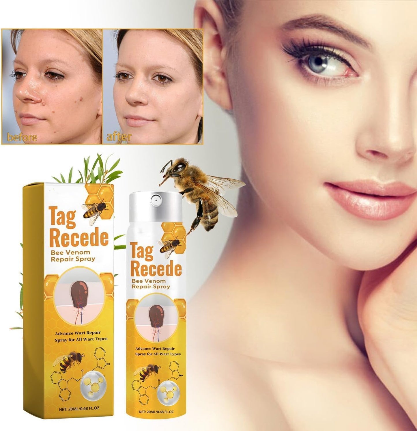 Wart Remover | Targeted Skin Spray | Bee Venom Care Formula | TagAway